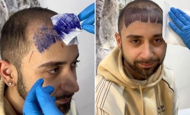 Vídeo: homem calvo tatua franja e chora ao ver resultado