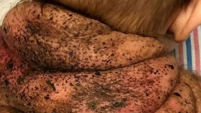 EUA: bebê nasce com