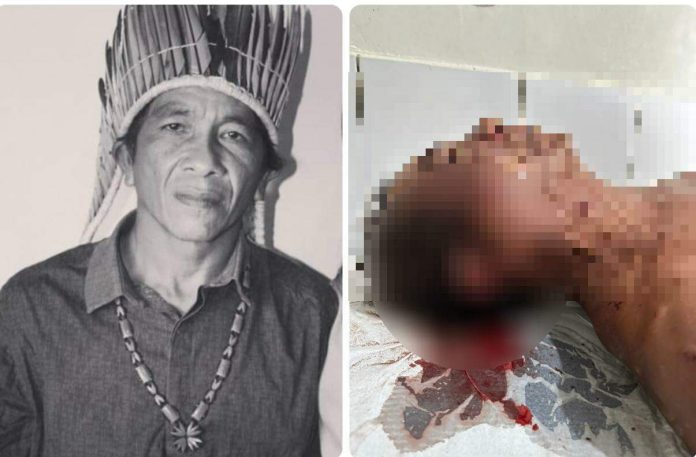 Liderança indígena de Tomé-Açu leva tiro na face durante atentado