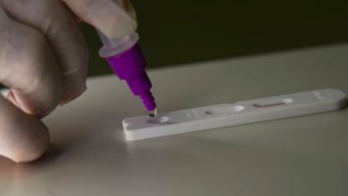 Polícia Federal investiga fraudes em testes de covid-19