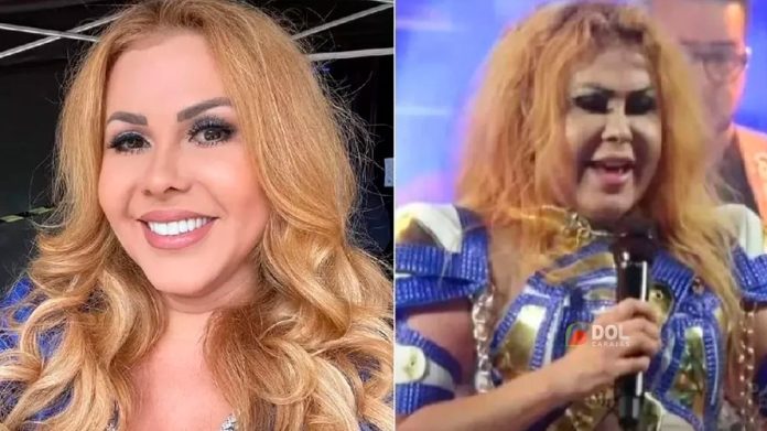 Fim da carreira? Entenda os problemas de saúde de Joelma!