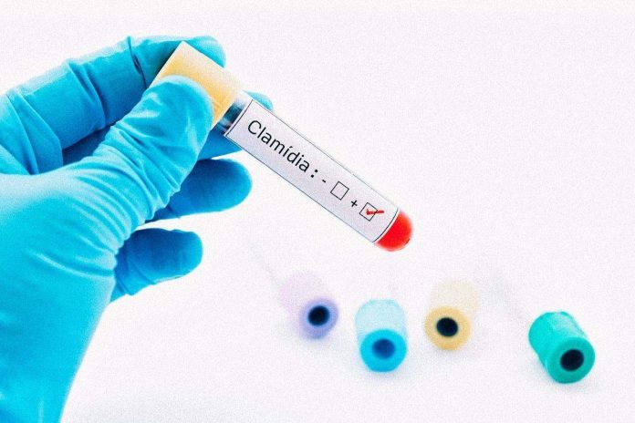 Pará treina equipes para ampliação de testes de clamídia e gonorreia